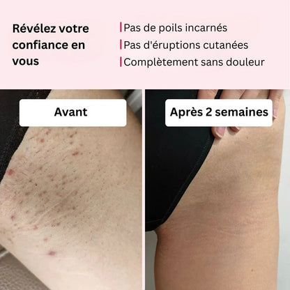Swifless™ Épilateur IPL - Appareil pour l'élimination des poils