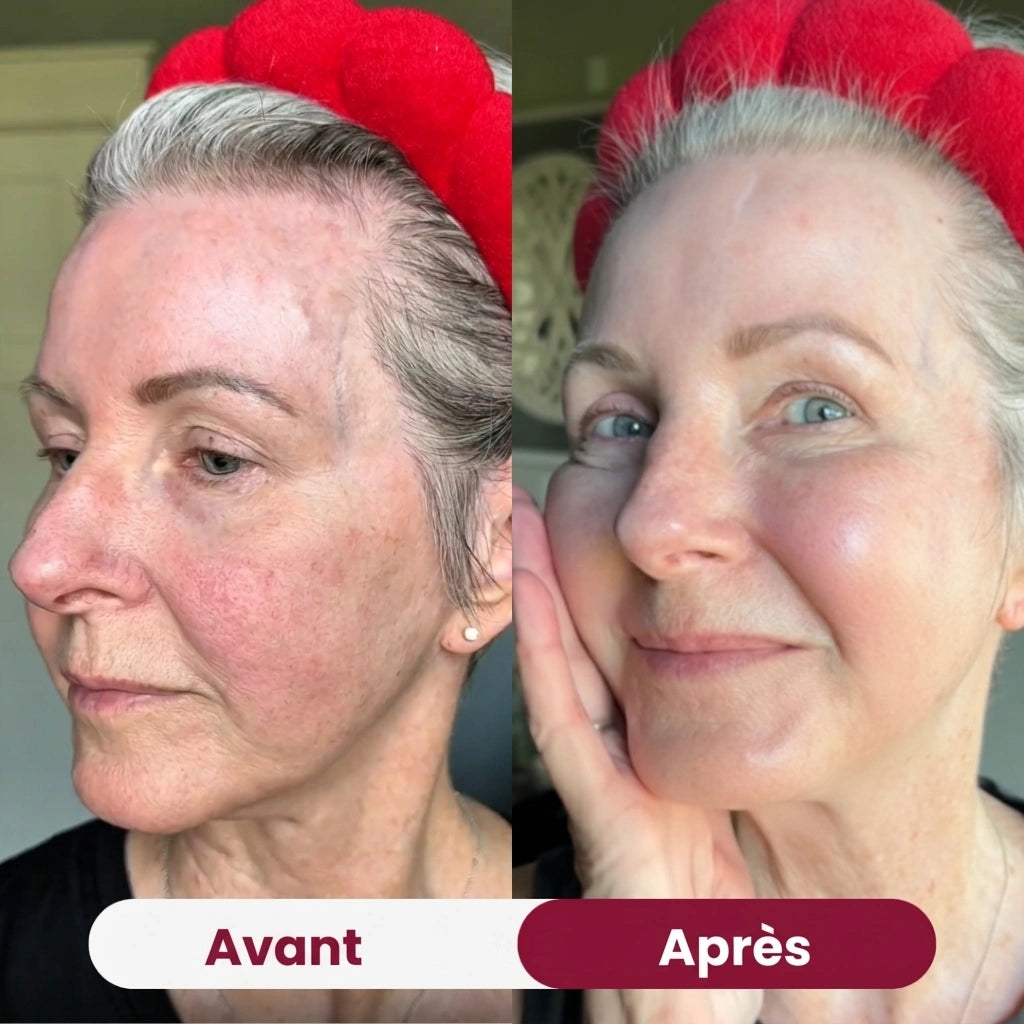 Swifless™ - Masque collagène bio