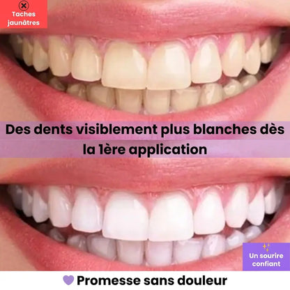 Swifless™ - Sérum correcteur de couleur