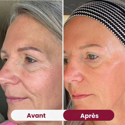Swifless™ - Masque collagène bio